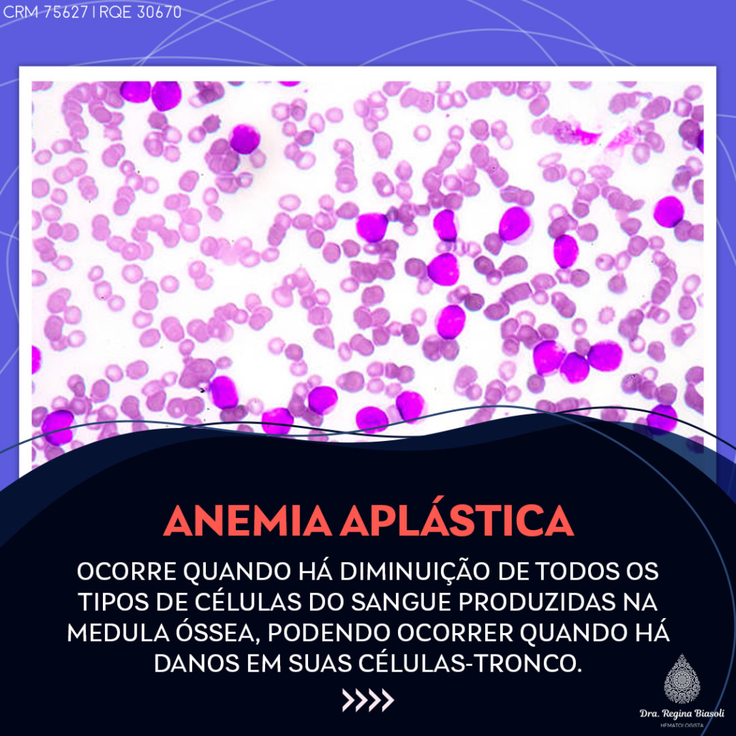 Tipos De Anemia Dra Regina Biasoli 