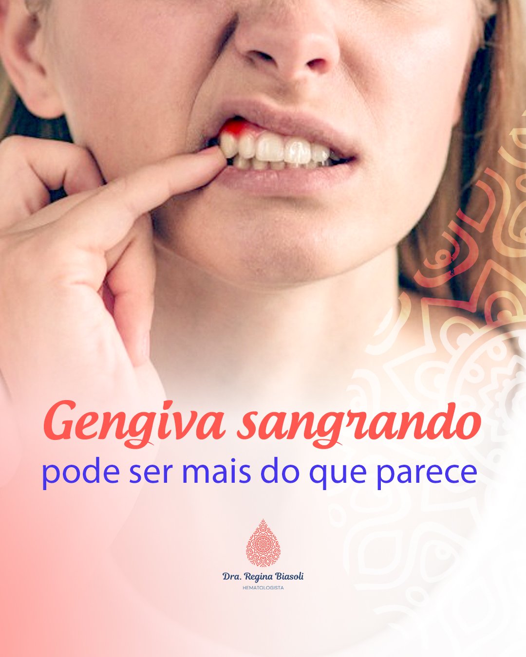 Gengiva sangrando pode ser mais do que parece